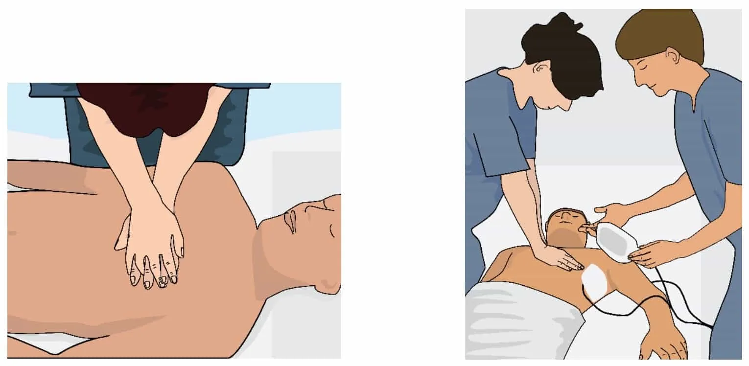 Locating the site of chest compressions in adult CPR