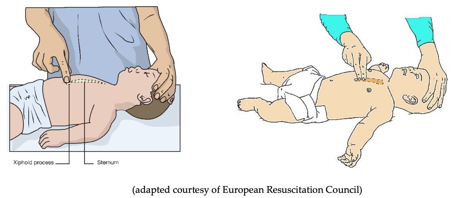 Locating the site of chest compressions in infant CPR