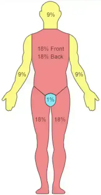 Adult Burns Assessment