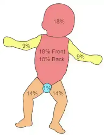 Child Burns Assessment