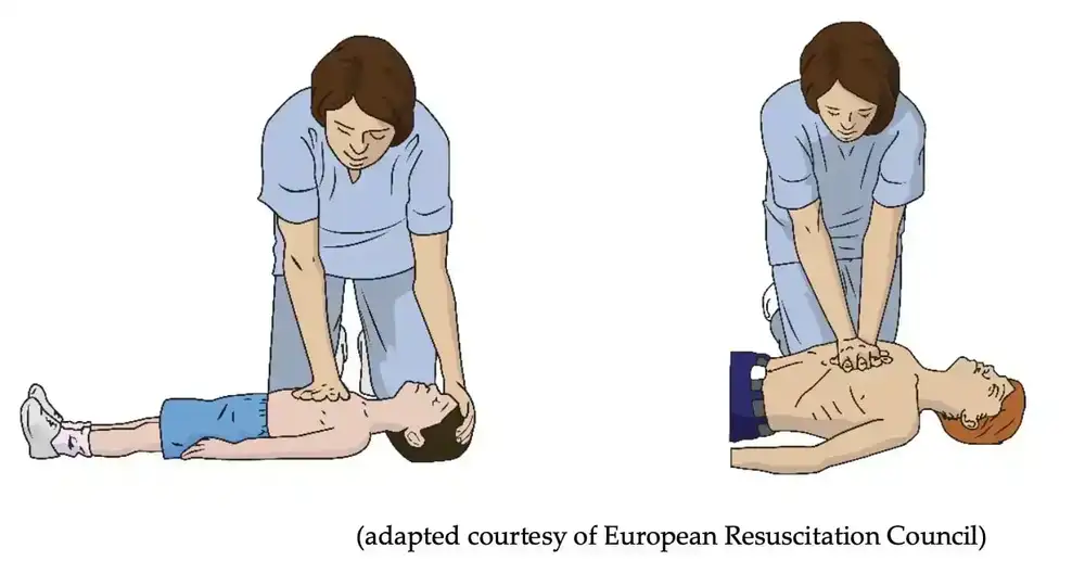 Figure 3: Administering compressions using one- and two-handed techniques