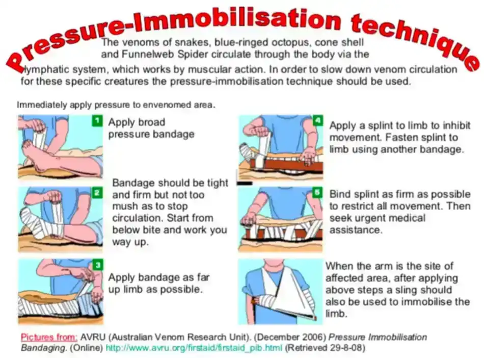 Pressure Immobilisation Technique