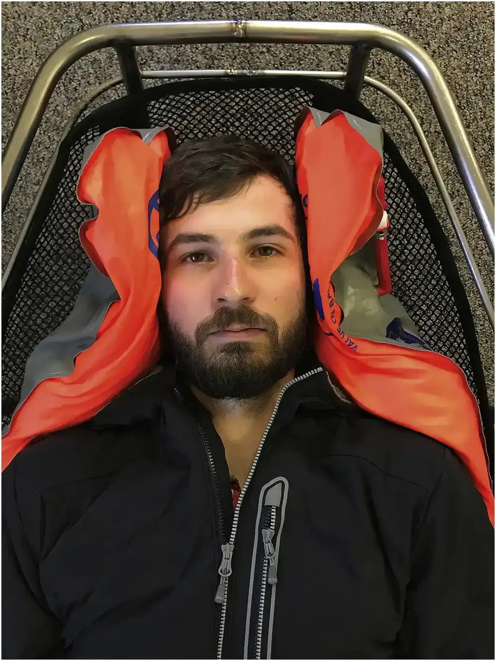 Figure 2. Demonstration of patient with spinal cord protection implemented via spinal motion restriction of the neck and back using a vacuum splint rather than rigid cervical collar and long board
