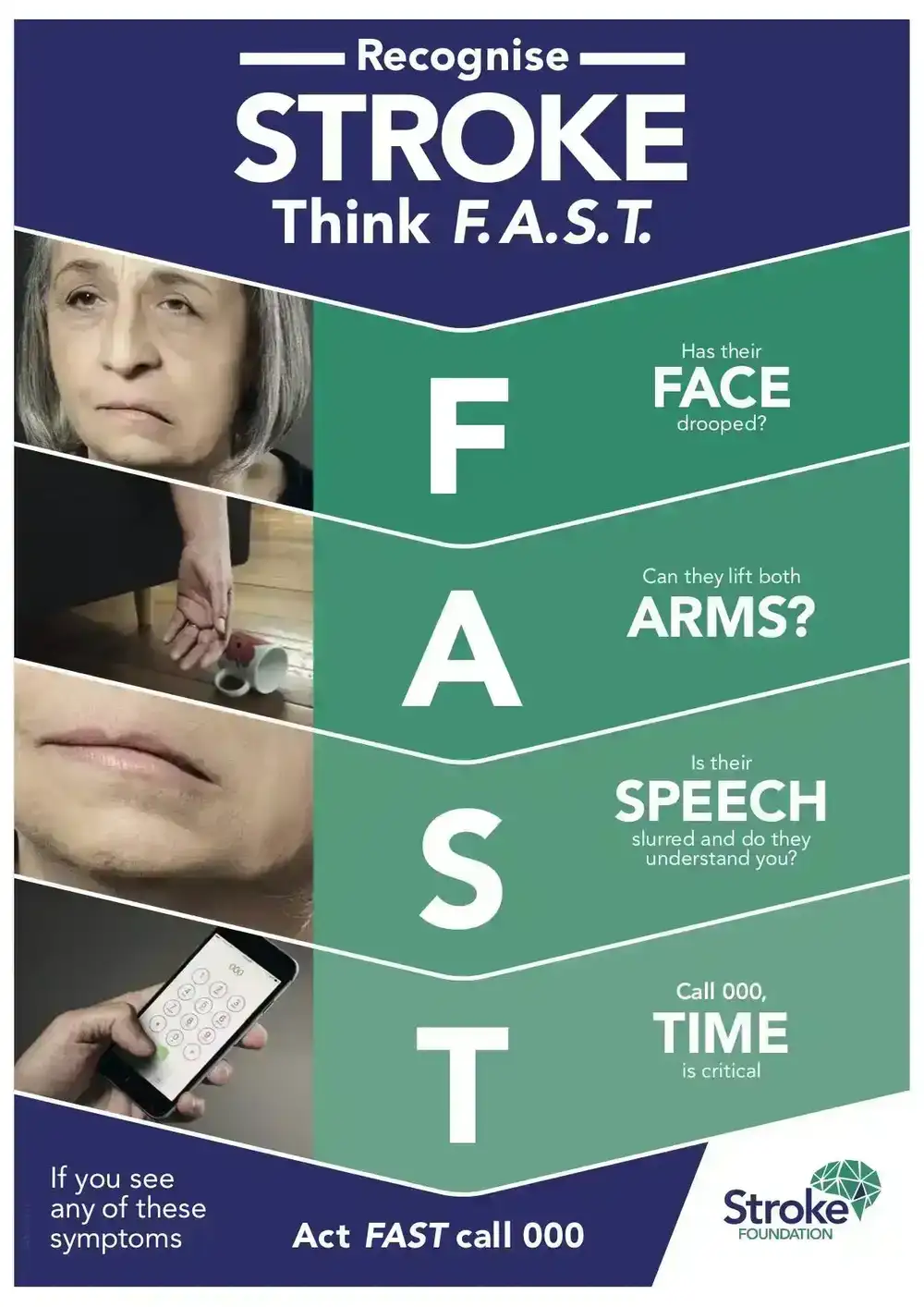 Stroke Management